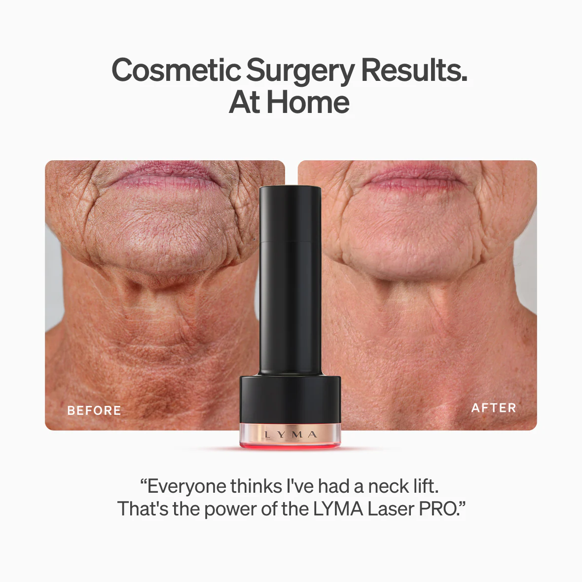 LYMA PRO Youth System Longevity Edition - Image 4
