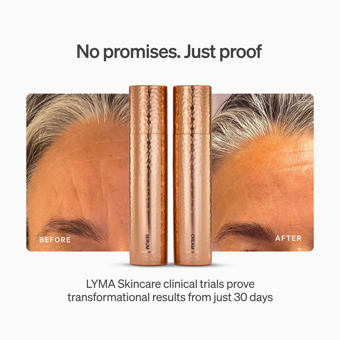 LYMA PRO Youth System Longevity Edition - Image 8