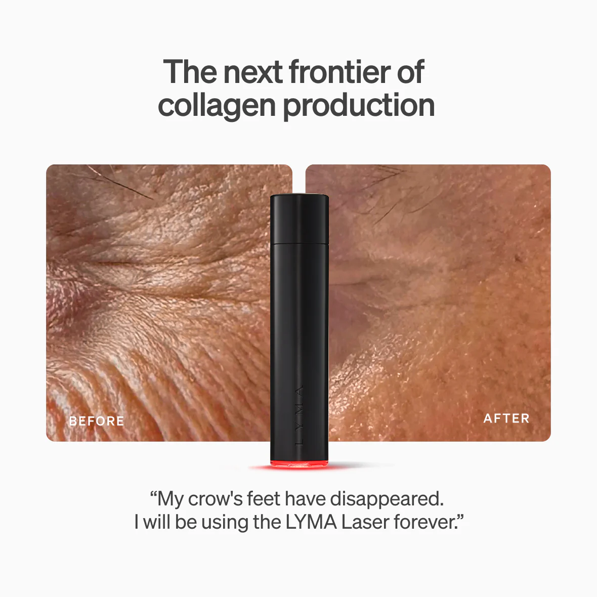 LYMA Laser - Image 3