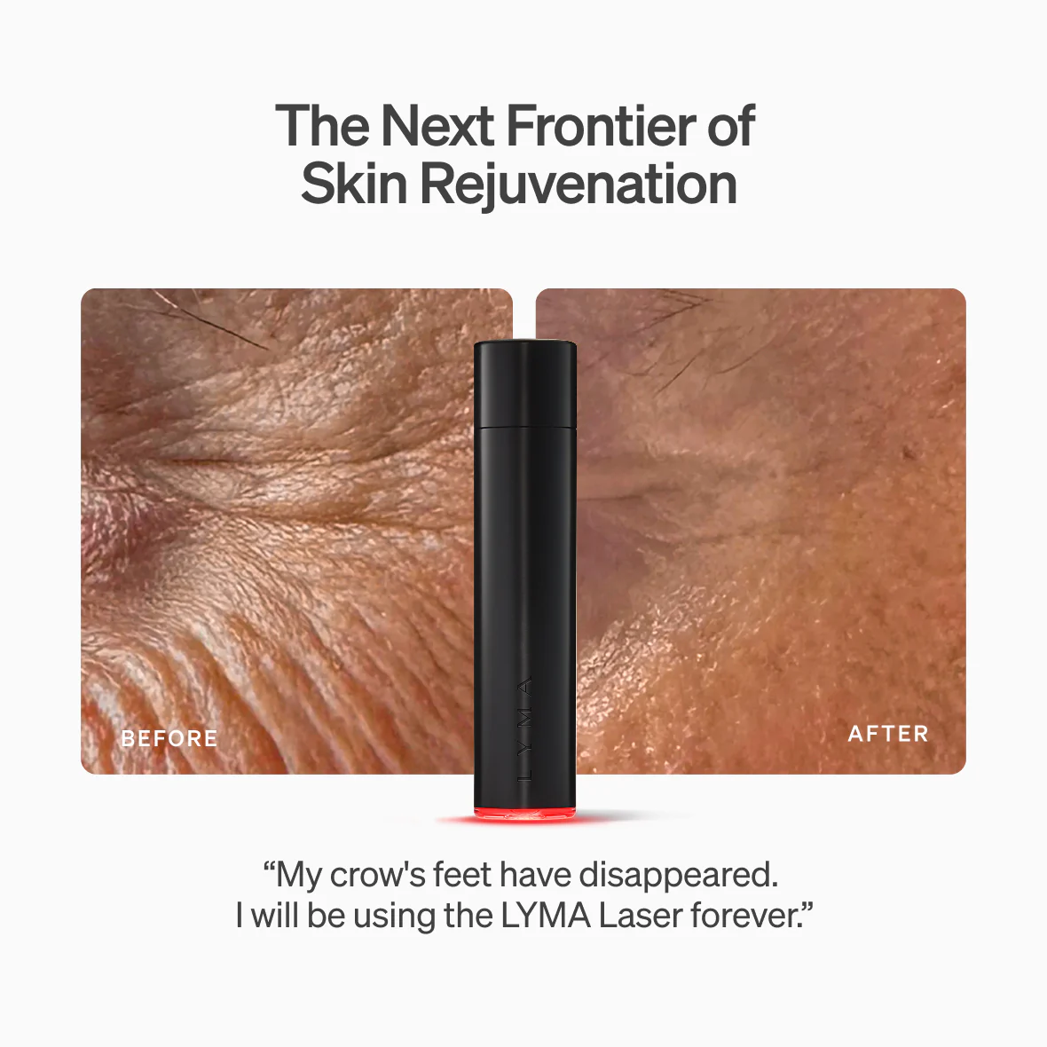LYMA Youth System Longevity Edition - Image 5